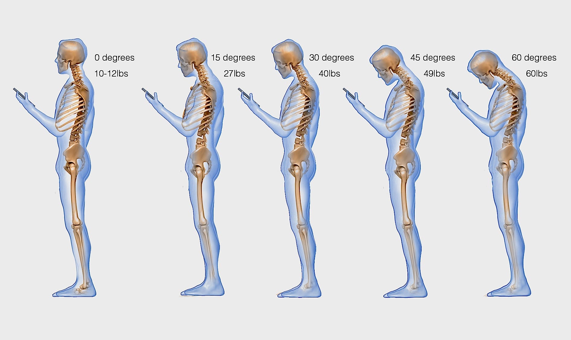 How Smartphone Use Is Affecting Your Spine