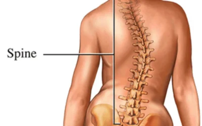 What is the Best Exercise for Scoliosis?